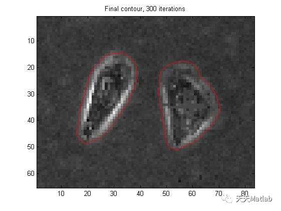 【图像分割】基于snake模型实现图像分割含Matlab源码