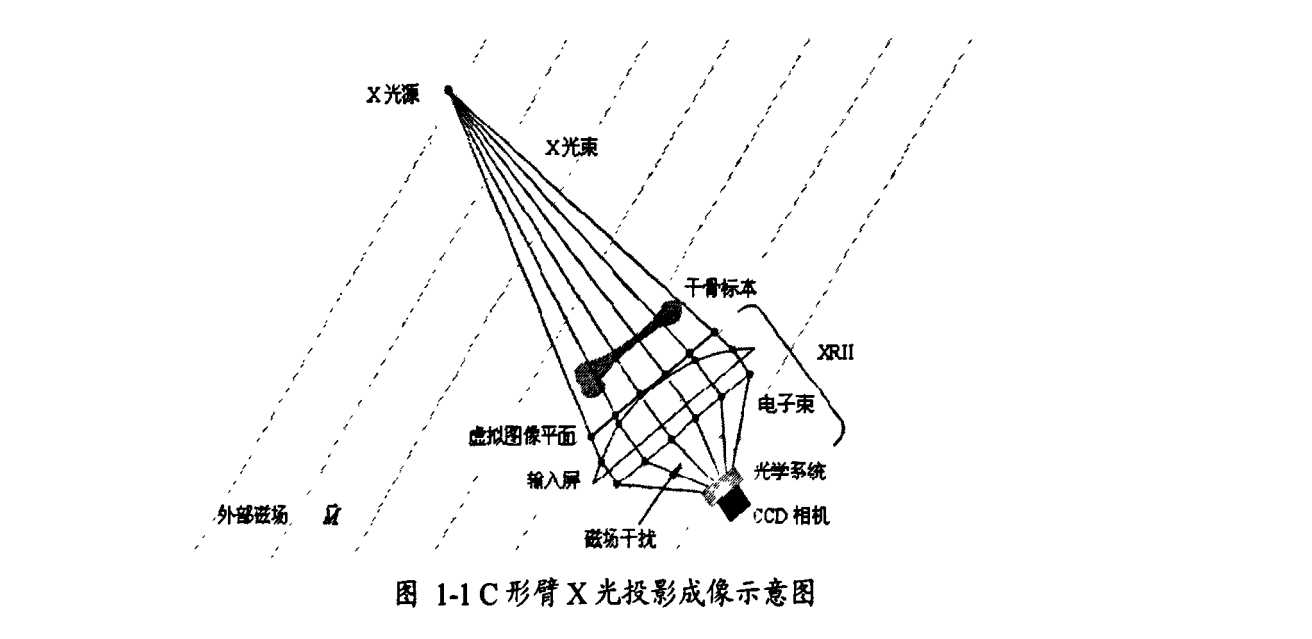 C-Arm X-Ray mechine Projection imaging diagram