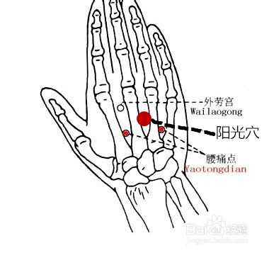 万一针万方琴老中医在哪里_万一针万方琴出版几本书[通俗易懂]