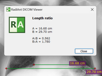 正版软件 | RadiAnt DICOM Viewer - 医学图像的PACS DICOM浏览器