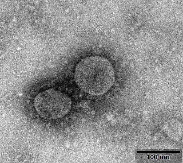 新型冠状病毒示意图是什么样的_新型冠状病毒现在什么样了