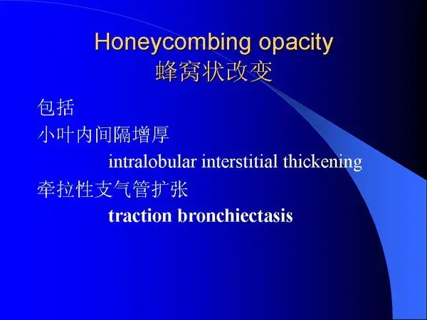 肺内基本病变的MSCT观察与分析