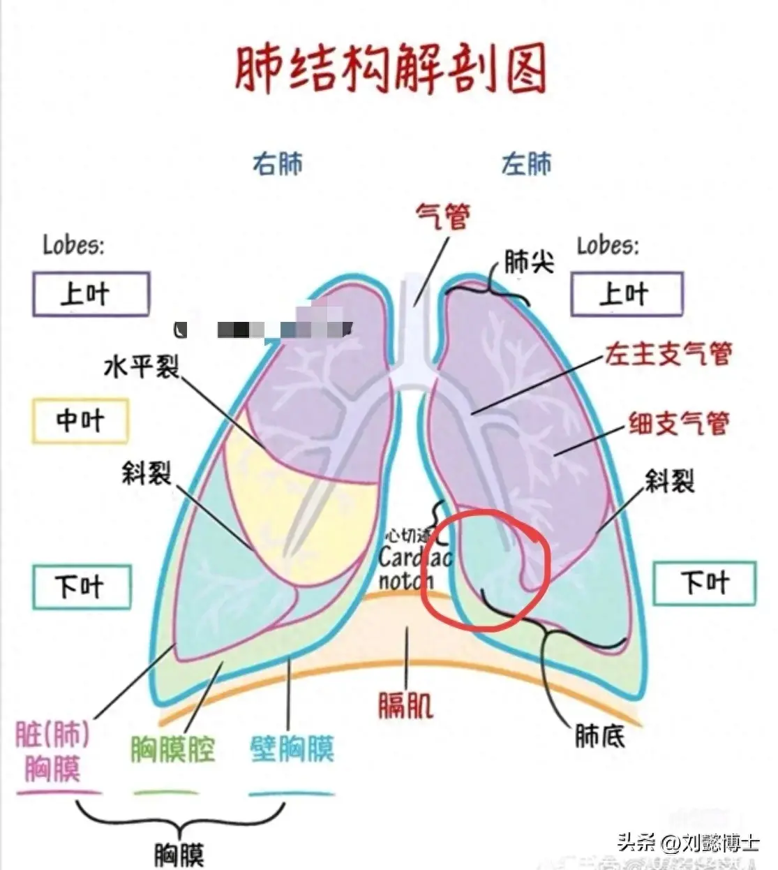 刘懿博士说肺癌（七六七九）想知道肺结节在什么部位？让我标出来