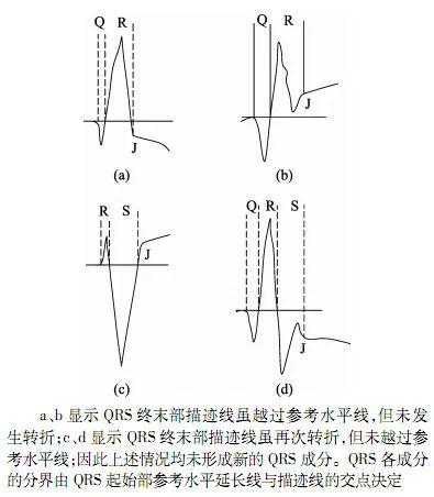 新版《心电图测量技术指南》，心内科医生都在转！