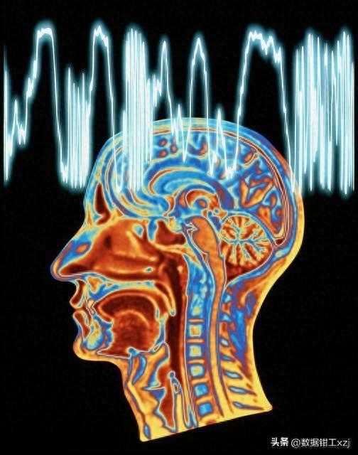 AI和脑电波结合