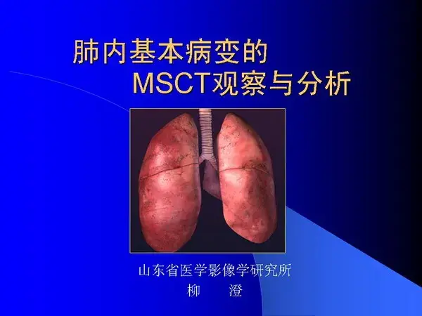 肺内基本病变的MSCT观察与分析