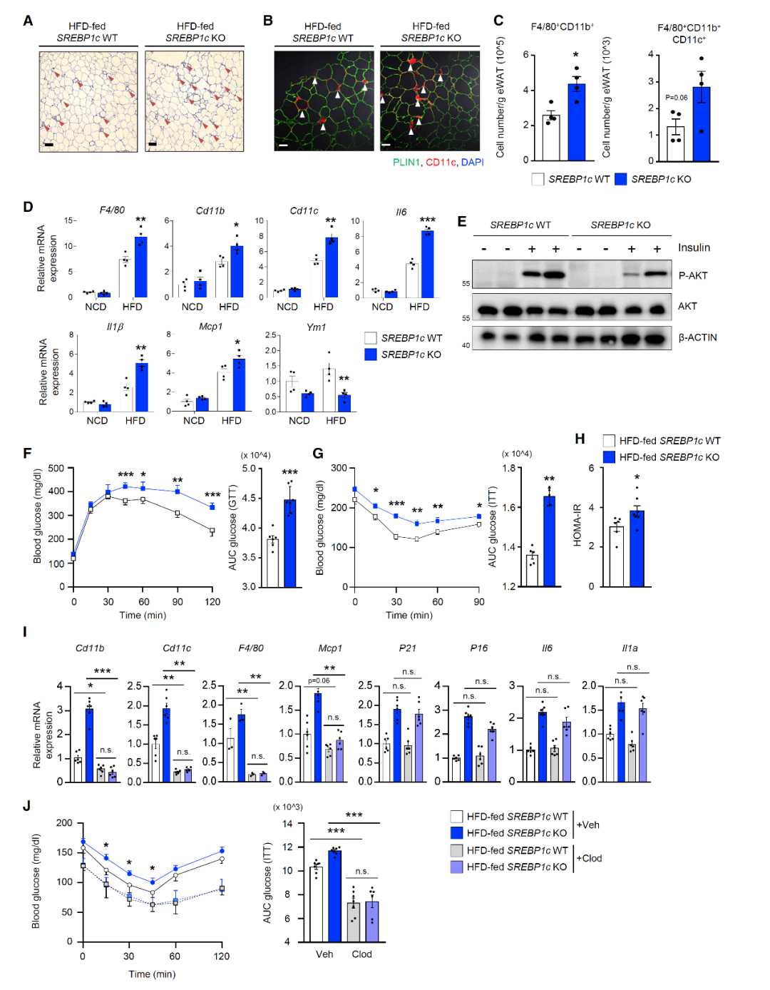 脂肪细胞衰老与肥胖及胰岛素抵抗：SREBP1c-PARP1轴调控DNA修复