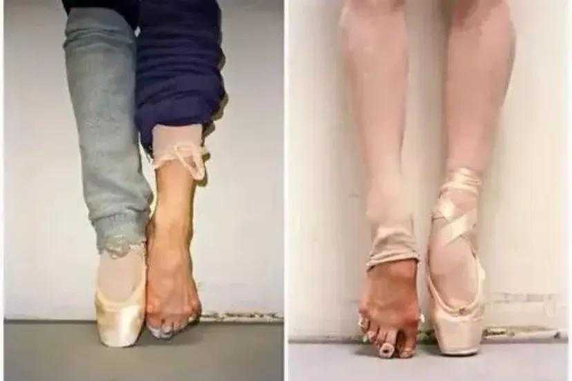 大家对于芭蕾的八大误区？你还在认为学芭蕾脚变形吗？