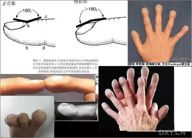 30 个骨科体征，总有一个你没见过