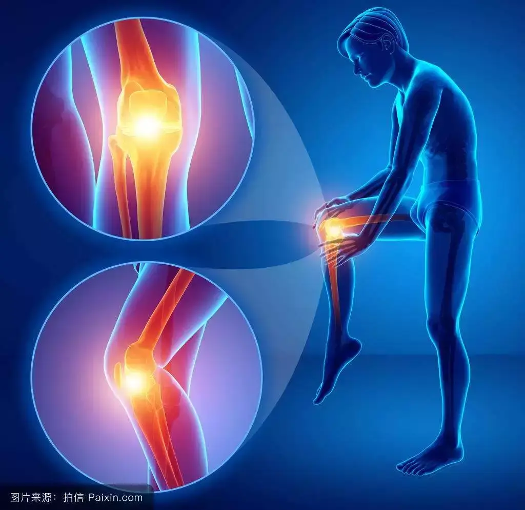 肠道菌群可使膝盖变得脆弱，诱发骨关节炎