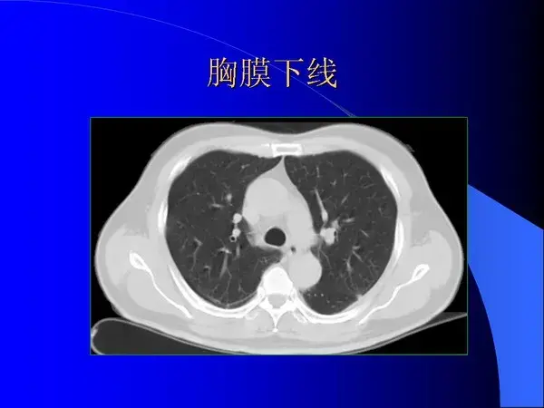 肺内基本病变的MSCT观察与分析