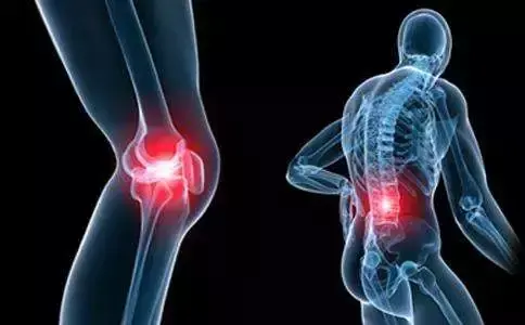 肠道菌群可使膝盖变得脆弱，诱发骨关节炎